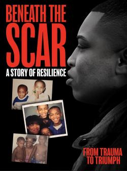 Beneath the Scar: A Story of Resilience (2025)