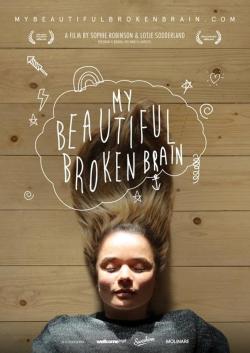 My Beautiful Broken Brain (2016)